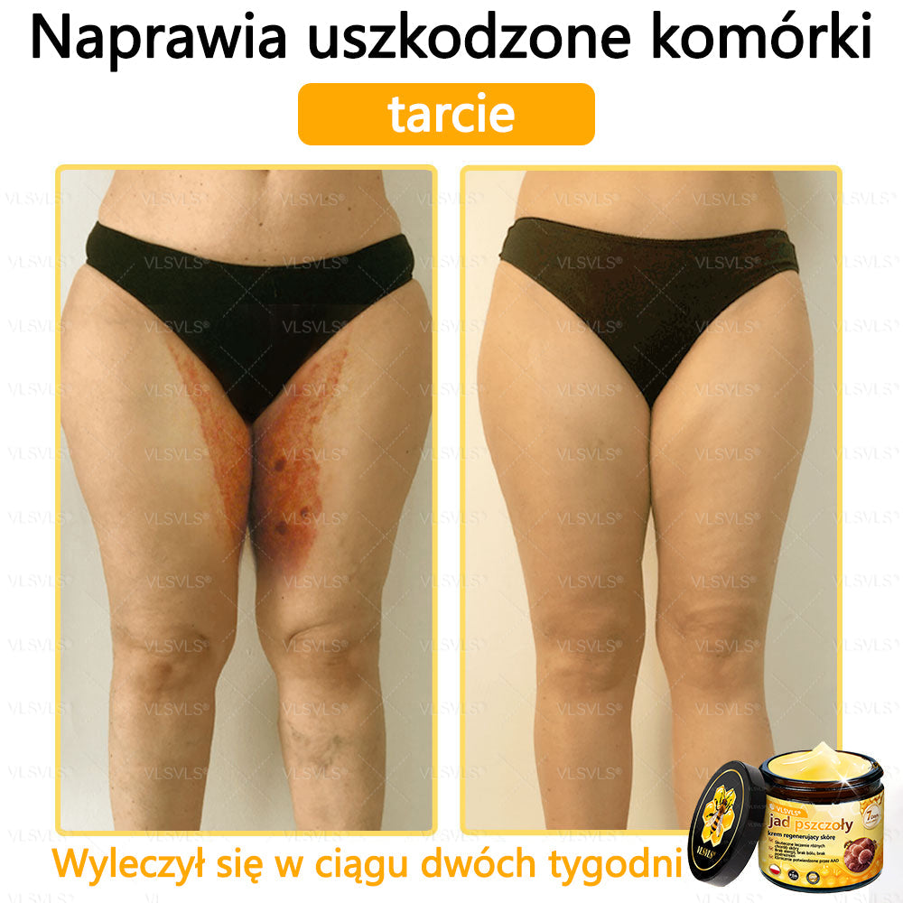 VLSVLS® Krem z jadem pszczelim do regeneracji skóry🌟 (👨⚕ odpowiedni dla wszystkich grup wiekowych, polecany przez AAD)