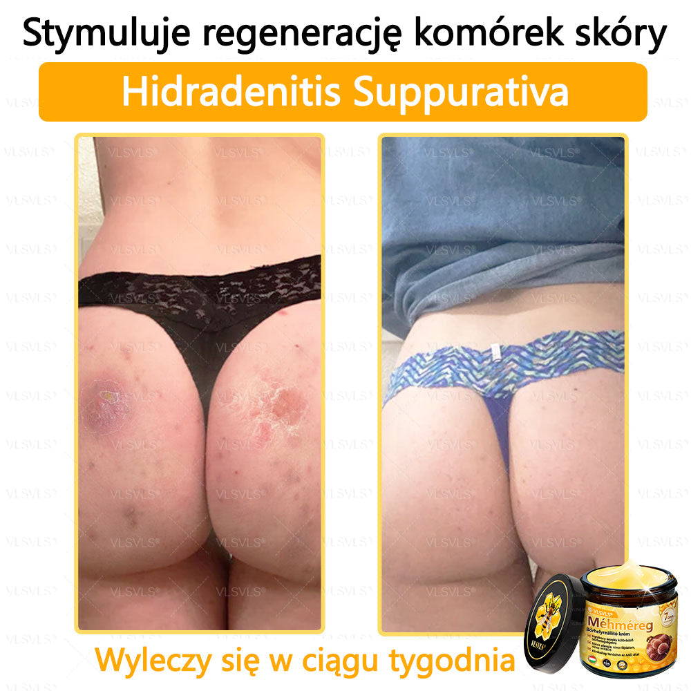 VLSVLS® Krem z jadem pszczelim do regeneracji skóry🌟 (👨⚕ odpowiedni dla wszystkich grup wiekowych, polecany przez AAD)