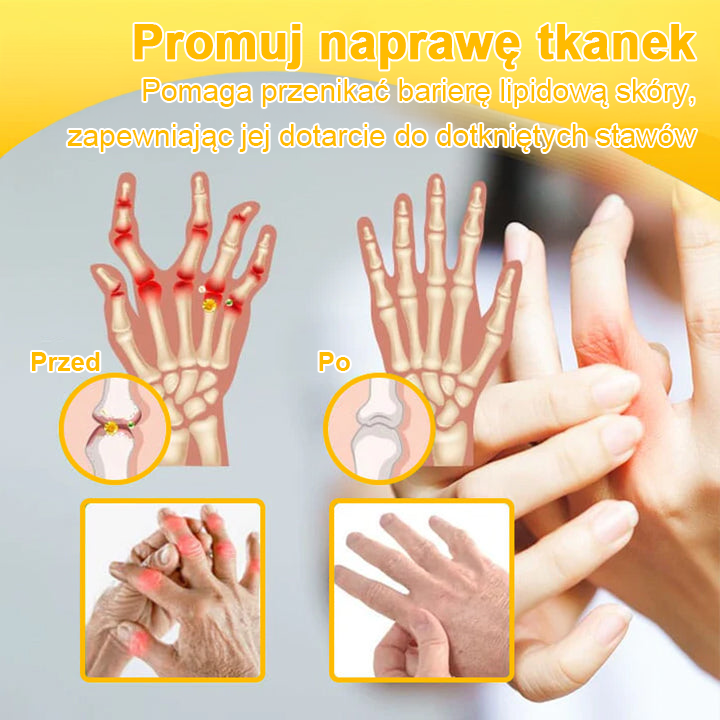 💎TLOPA® Toksyna botulinowa i jad pszczeli Balsam Łagodzący Ból i Leczenie Kości🐝🌿 (Polecane dla seniorów przez ortopedów)🦴