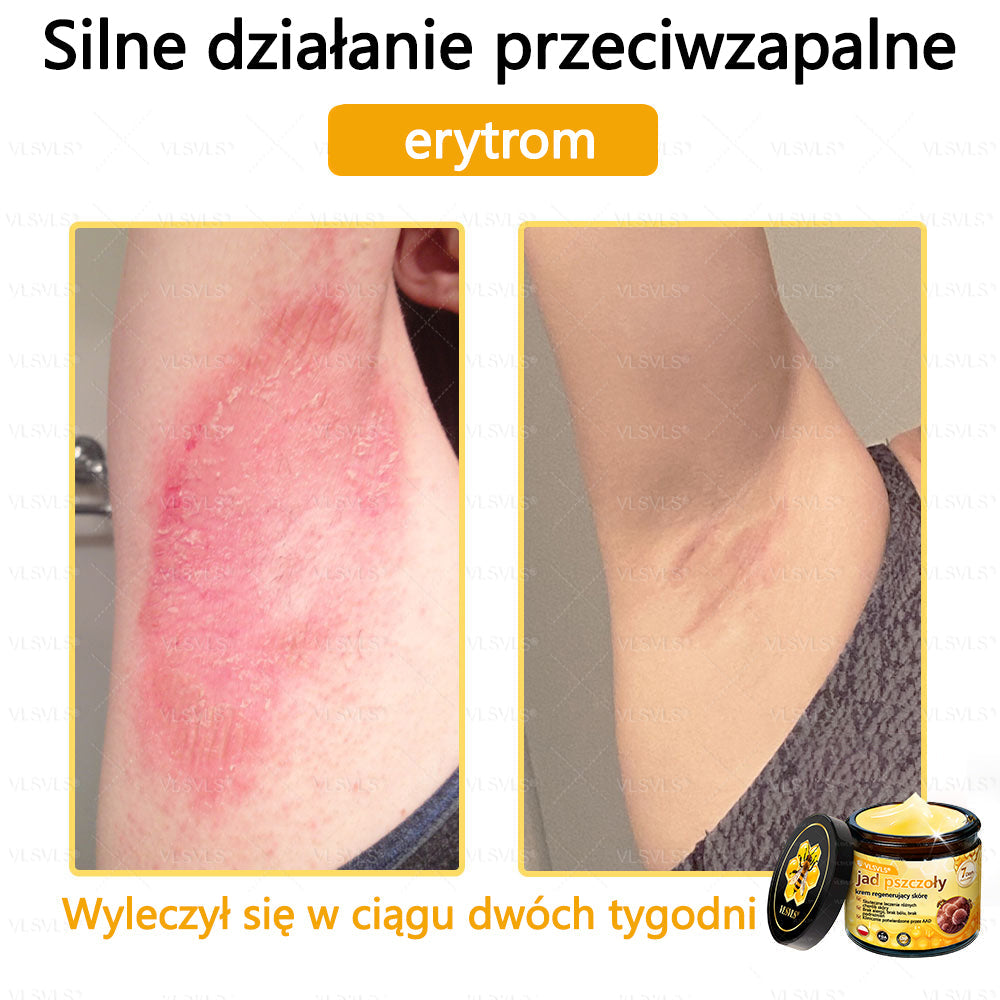 VLSVLS® Krem z jadem pszczelim do regeneracji skóry🌟 (👨⚕ odpowiedni dla wszystkich grup wiekowych, polecany przez AAD)