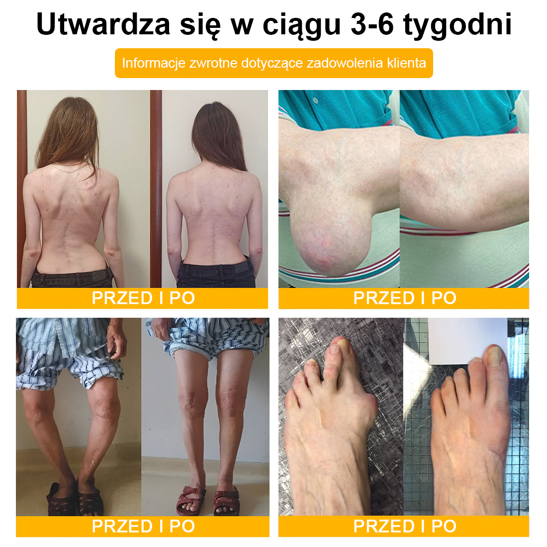 💎TLOPA® Toksyna botulinowa i jad pszczeli Balsam Łagodzący Ból i Leczenie Kości🐝🌿 (Polecane dla seniorów przez ortopedów)🦴