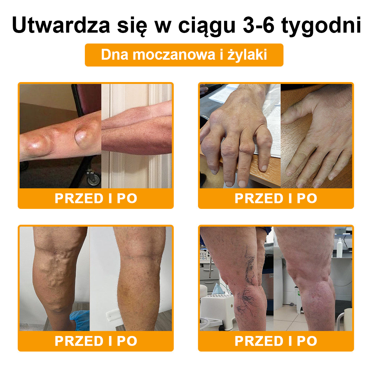 💎TLOPA® Toksyna botulinowa i jad pszczeli Balsam Łagodzący Ból i Leczenie Kości🐝🌿 (Polecane dla seniorów przez ortopedów)🦴