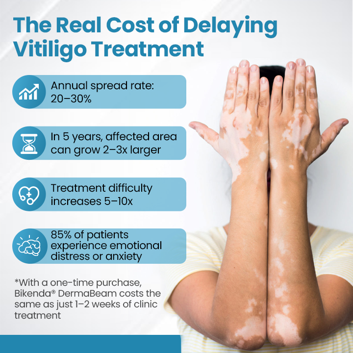 Bikenda® DermaBeam Vitiligo Therapy Device ✅3-5 Second Vitiligo Treatment, Visible Results in Just 2 Weeks