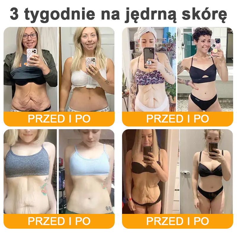 VLSVLS® Krem z jadem pszczelim do regeneracji skóry (👨⚕ odpowiedni dla wszystkich grup wiekowych, polecany przez AAD) 🌟