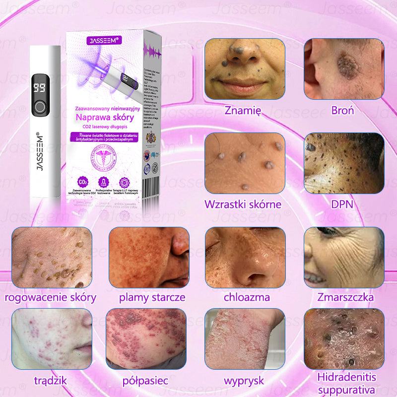 💎𝐉𝐚𝐬𝐬𝐞𝐞𝐦® Zaawansowany nieinwazyjny laser CO₂ do naprawy skóry 🎉 (Delikatnie usuwa brodawki, znamiona, plamy starcze i narośla skórne – bez bólu, bez zamieszania!)