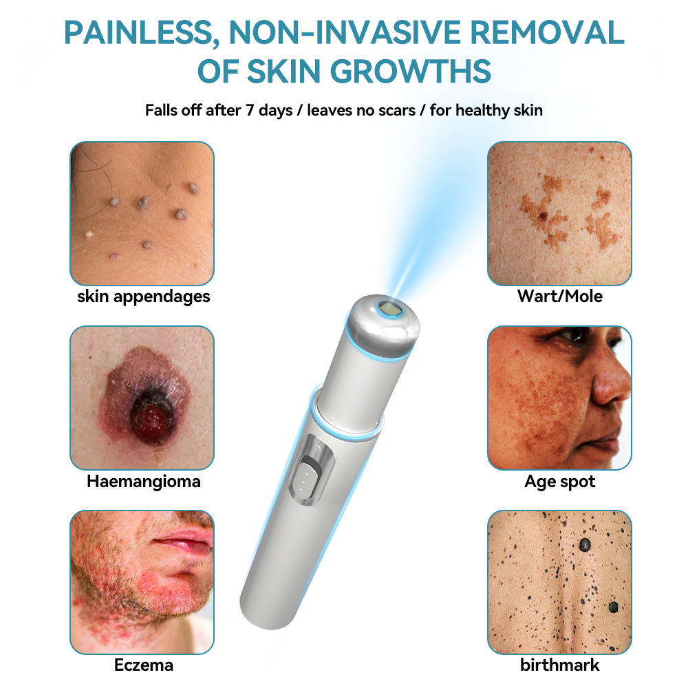 ๐๐๐ฌ๐ฌ๐๐๐ฆยฎ ๐ณMedical-Grade Laser Pen (Powered by COโ laser technology โ effectively removes moles, warts, skin tags, pigmentation spots, and other skin imperfections)