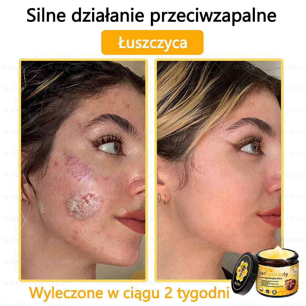 VLSVLS® Krem z jadem pszczelim do regeneracji skóry🌟 (👨⚕ odpowiedni dla wszystkich grup wiekowych, polecany przez AAD)