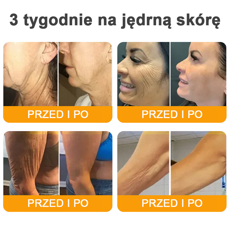 VLSVLS® Krem z jadem pszczelim do regeneracji skóry (👨⚕ odpowiedni dla wszystkich grup wiekowych, polecany przez AAD) 🌟
