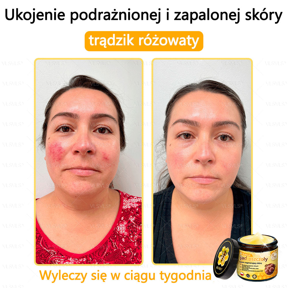 VLSVLS® Krem z jadem pszczelim do regeneracji skóry🌟 (👨⚕ odpowiedni dla wszystkich grup wiekowych, polecany przez AAD)