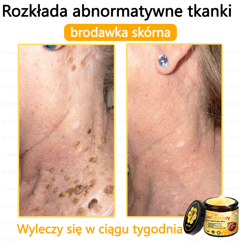 VLSVLS® Krem z jadem pszczelim do regeneracji skóry🌟 (👨⚕ odpowiedni dla wszystkich grup wiekowych, polecany przez AAD)