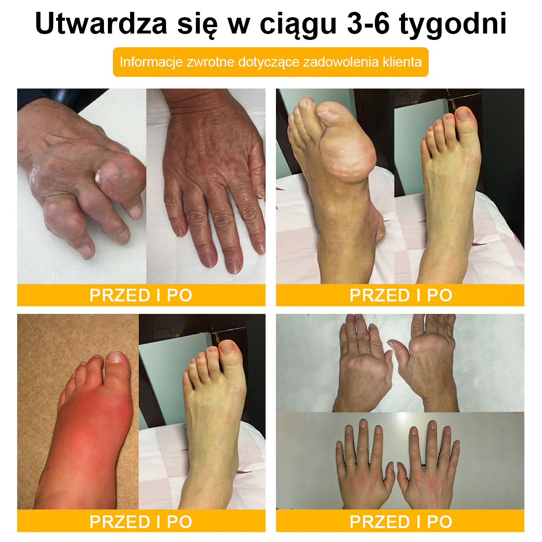 💎TLOPA® Toksyna botulinowa i jad pszczeli Balsam Łagodzący Ból i Leczenie Kości🐝🌿 (Polecane dla seniorów przez ortopedów)🦴