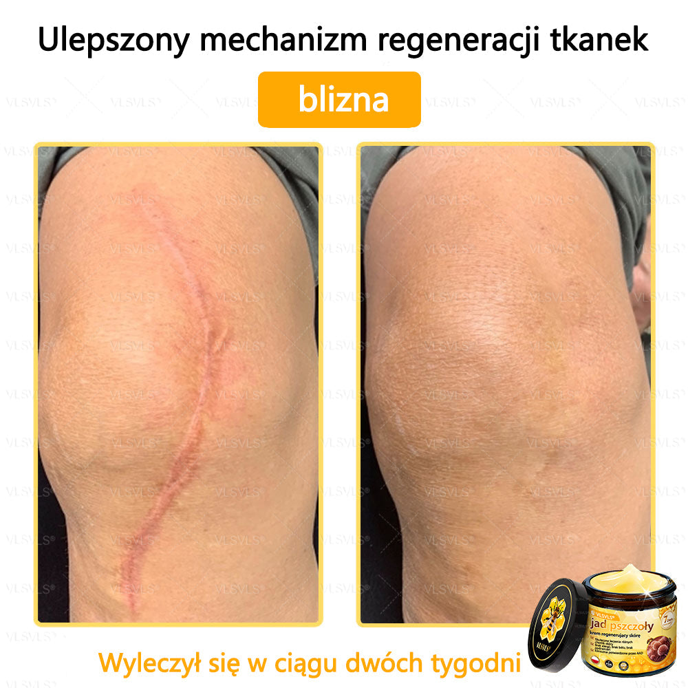 VLSVLS® Krem z jadem pszczelim do regeneracji skóry🌟 (👨⚕ odpowiedni dla wszystkich grup wiekowych, polecany przez AAD)