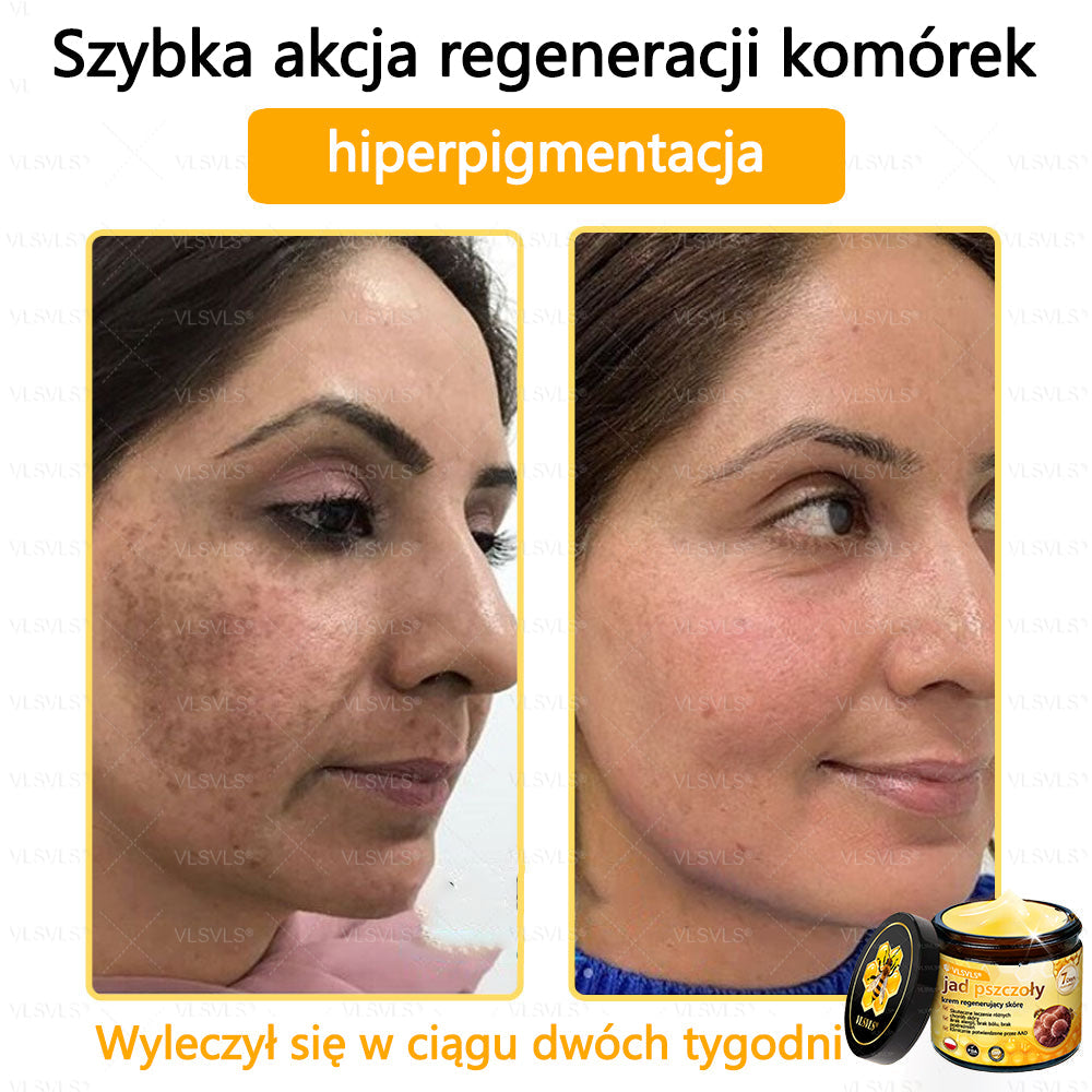 VLSVLS® Krem z jadem pszczelim do regeneracji skóry🌟 (👨⚕ odpowiedni dla wszystkich grup wiekowych, polecany przez AAD)