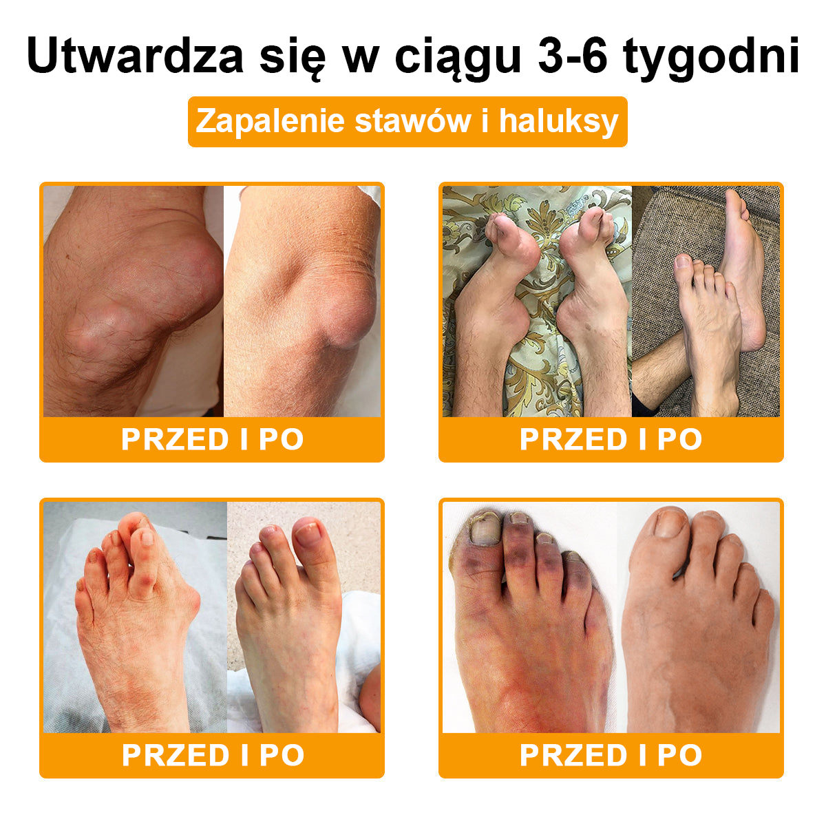 💎TLOPA® Toksyna botulinowa i jad pszczeli Balsam Łagodzący Ból i Leczenie Kości🐝🌿 (Polecane dla seniorów przez ortopedów)🦴