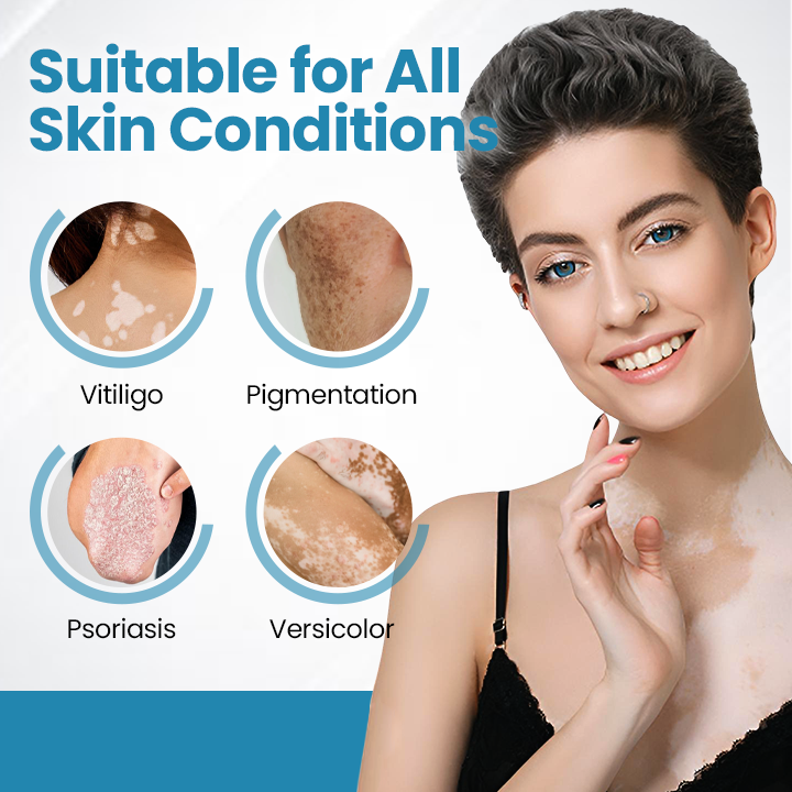 Bikenda® DermaBeam Vitiligo Therapy Device ✅3-5 Second Vitiligo Treatment, Visible Results in Just 2 Weeks