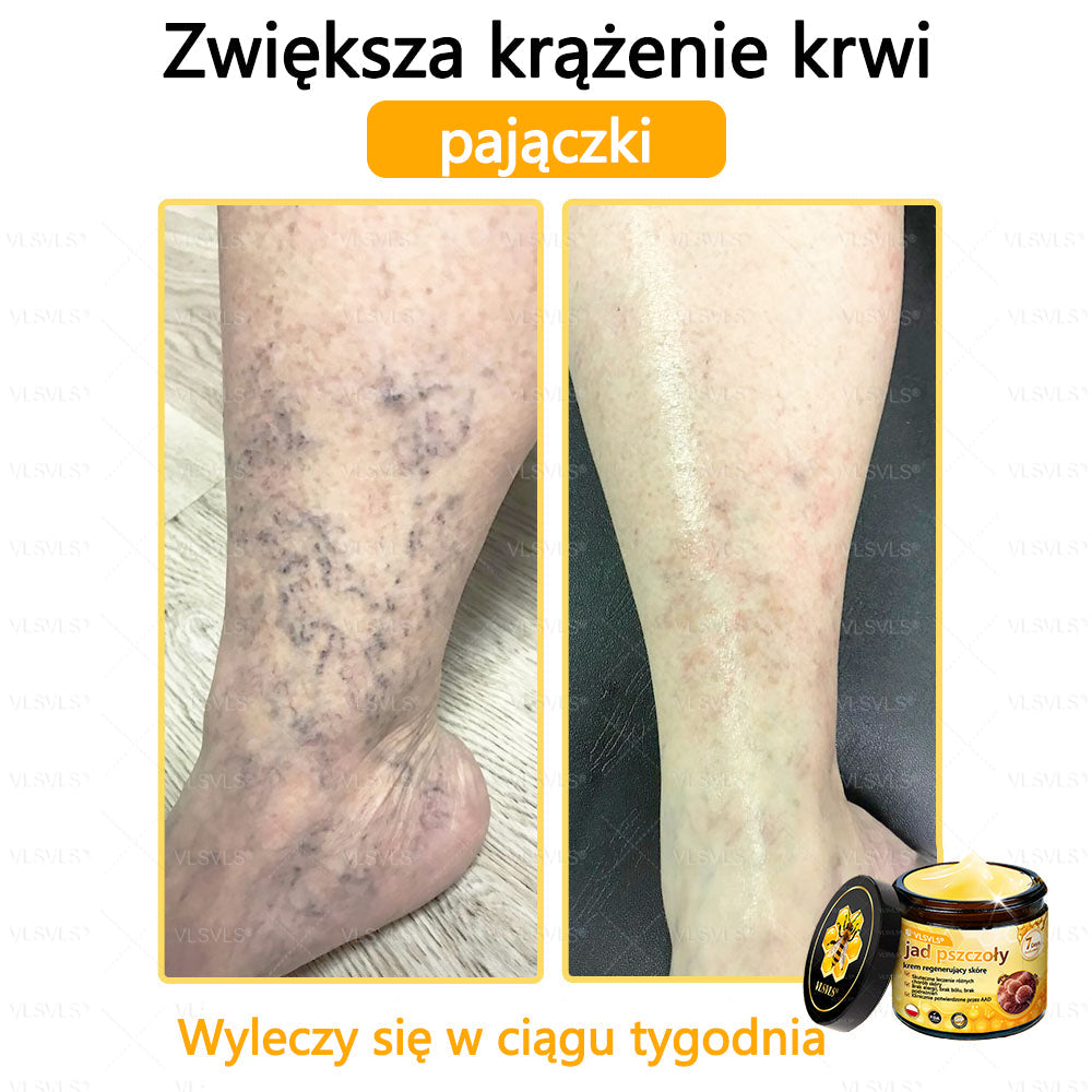 VLSVLS® Krem z jadem pszczelim do regeneracji skóry🌟 (👨⚕ odpowiedni dla wszystkich grup wiekowych, polecany przez AAD)