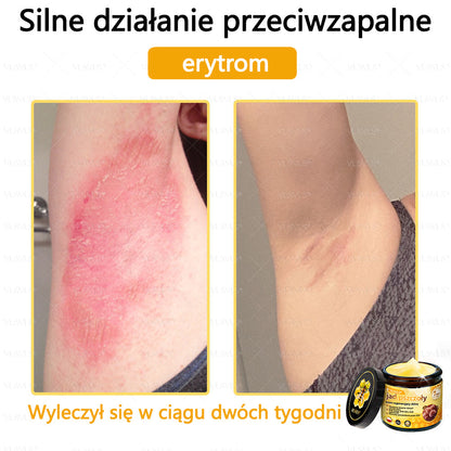 VLSVLS® Krem z jadem pszczelim do regeneracji skóry🌟 (👨‍⚕‍ odpowiedni dla wszystkich grup wiekowych, polecany przez AAD)