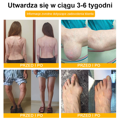 💎TLOPA® Toksyna botulinowa i jad pszczeli Balsam Łagodzący Ból i Leczenie Kości🐝🌿 (Polecane dla seniorów przez ortopedów)🦴