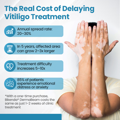 Bikenda® DermaBeam Vitiligo Therapy Device ✅3-5 Second Vitiligo Treatment, Visible Results in Just 2 Weeks
