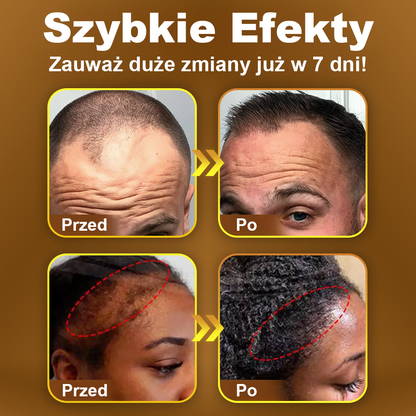 TLOPA® Kapsułki na porost włosów💎