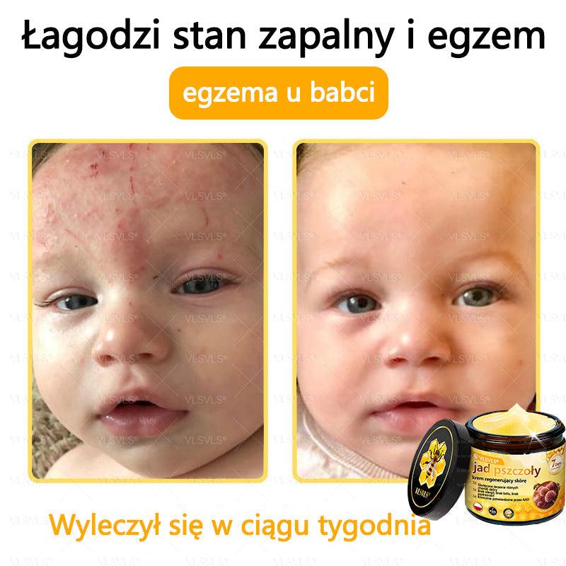 VLSVLS® Krem z jadem pszczelim do regeneracji skóry🌟 (👨‍⚕‍ odpowiedni dla wszystkich grup wiekowych, polecany przez AAD)