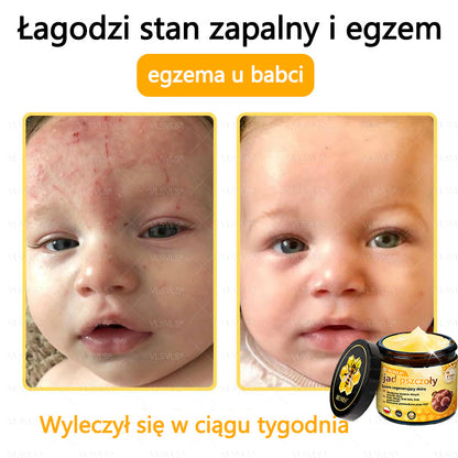 VLSVLS® Krem z jadem pszczelim do regeneracji skóry🌟 (👨‍⚕‍ odpowiedni dla wszystkich grup wiekowych, polecany przez AAD)