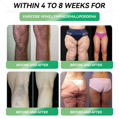 𝑶𝒇𝒇𝒊𝒄𝒊𝒂𝒍 𝑺𝒕𝒐𝒓𝒆 |🇬🇧𝐒𝐓𝐃𝐄𝐈® 𝐆𝐋𝐏-𝟏 𝐒𝗹𝐢𝐦𝐦𝐢𝐧𝐠 & 𝐇𝐞𝐚𝗹𝐭𝐡 𝐈𝐦𝐩𝐫𝐨𝐯𝐞𝐦𝐞𝐧𝐭 𝐀𝐦𝐩𝐨𝐮𝗹𝐞 𝐃𝐫𝐨𝐩𝐬✅𝐉𝐮𝐬𝐭 𝐨𝐧𝐜𝐞 𝐚 𝐝𝐚𝐲, 𝐯𝐢𝐬𝐢𝐛𝐥𝐞 𝐜𝐡𝐚𝐧𝐠𝐞𝐬 𝐢𝐧 𝟕 𝐝𝐚𝐲𝐬🍃