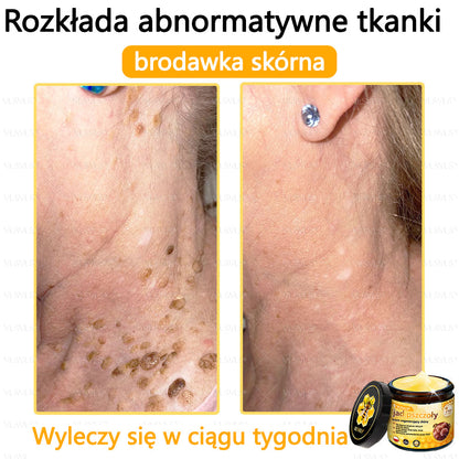 VLSVLS® Krem z jadem pszczelim do regeneracji skóry🌟 (👨‍⚕‍ odpowiedni dla wszystkich grup wiekowych, polecany przez AAD)