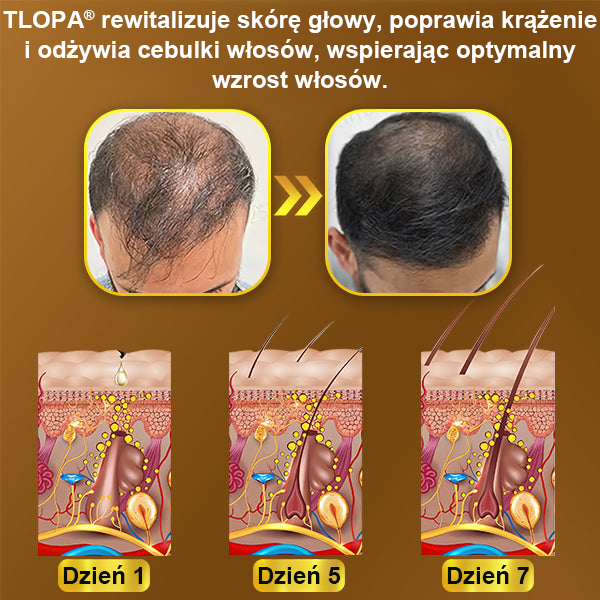 TLOPA® Kapsułki na porost włosów💎