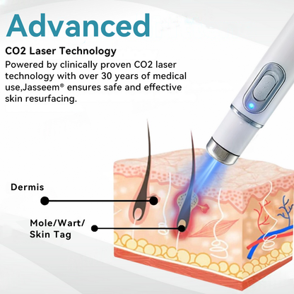 𝐉𝐚𝐬𝐬𝐞𝐞𝐦® 🌳Medical-Grade Laser Pen (Powered by CO₂ laser technology – effectively removes moles, warts, skin tags, pigmentation spots, and other skin imperfections)
